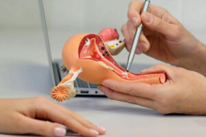 Лечение бартолинита в Израиле