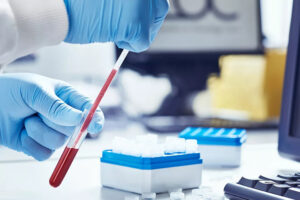 Гормональный профиль